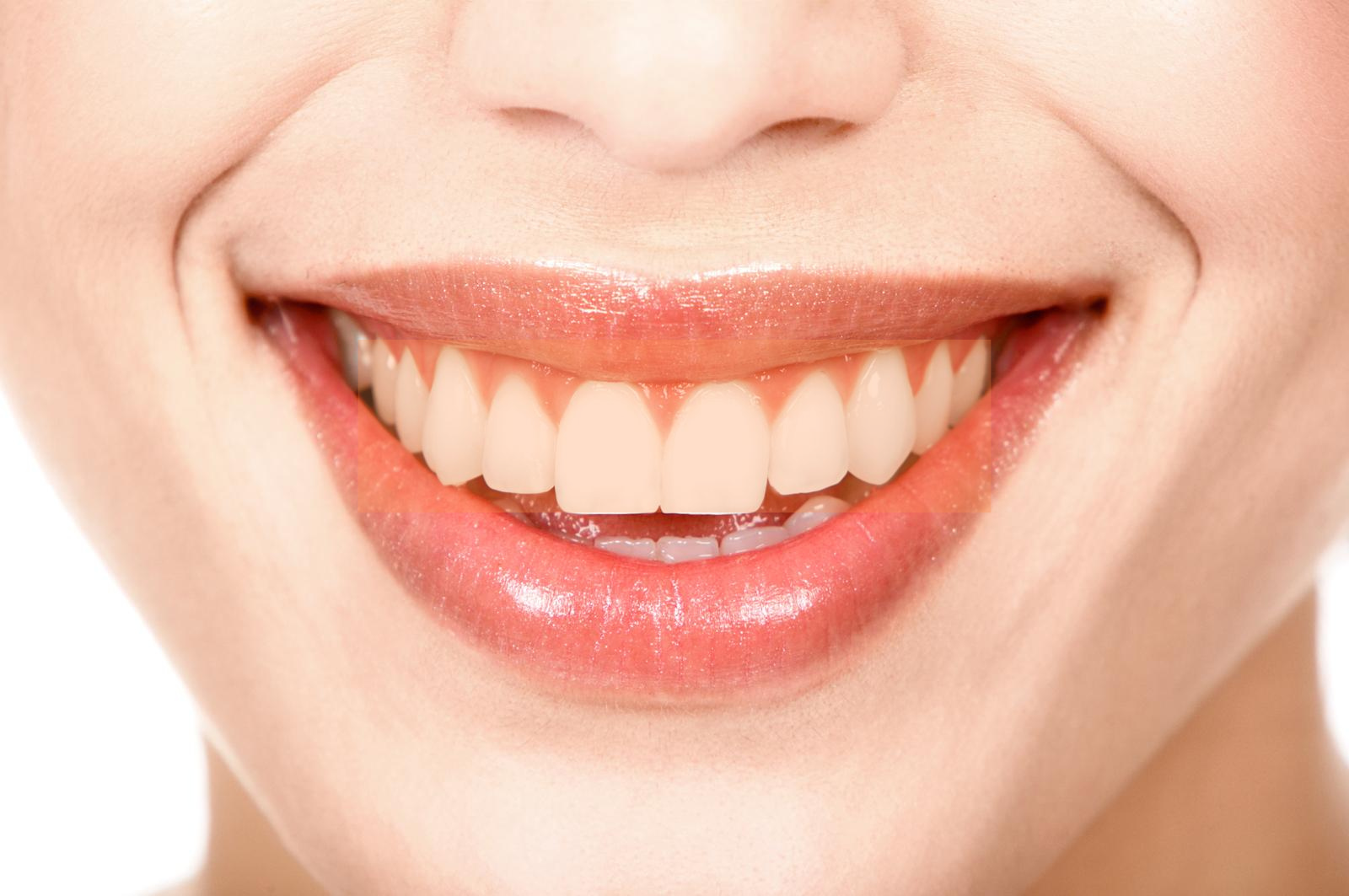 Blanqueamiento dental antes